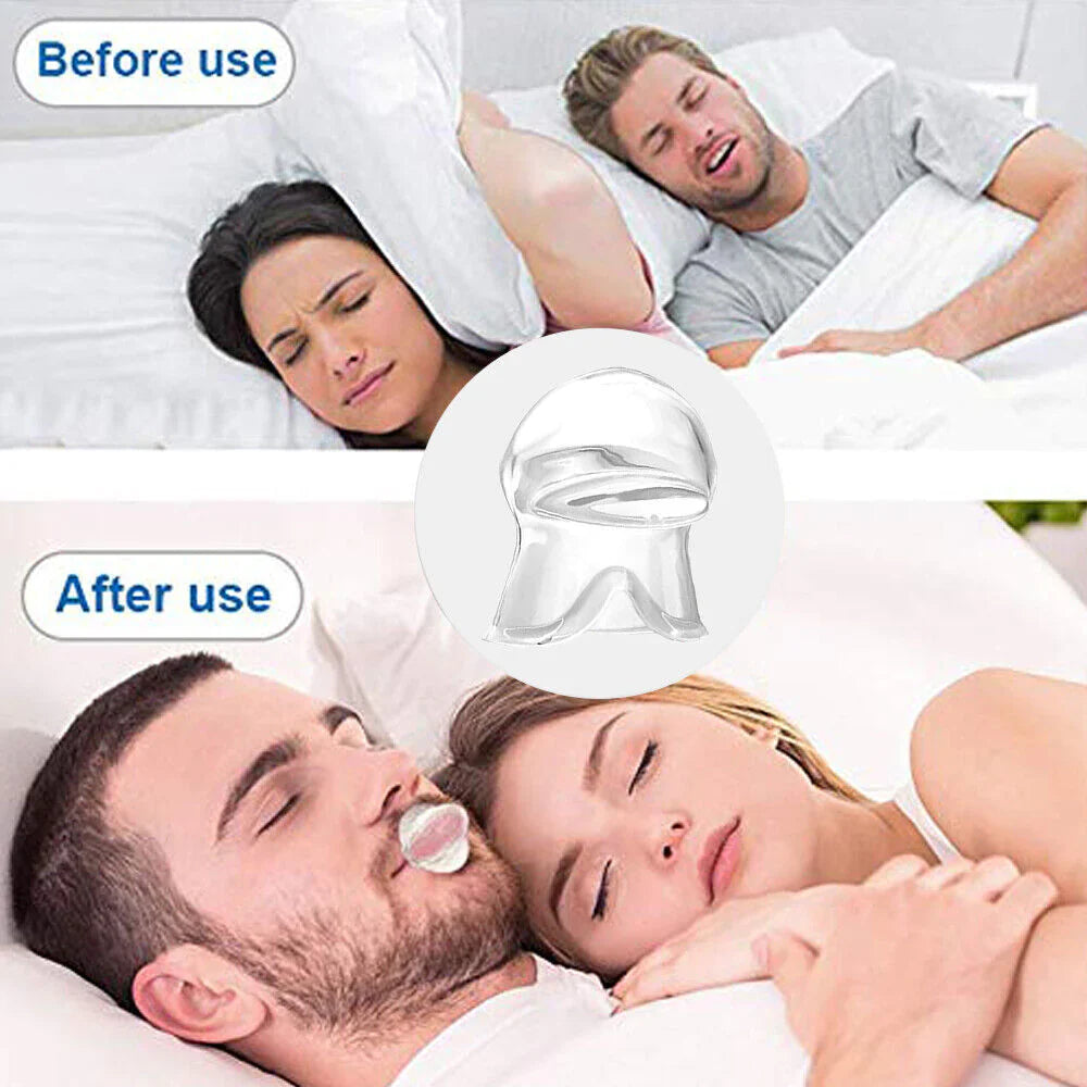 SnoreSnoozer Pro - Instant Snoring Relief